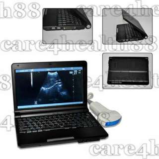CE proved Digital Laptop Ultrasound Scanner/machine with Convex or 