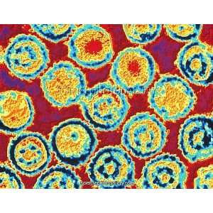  Coloured TEM of Epstein Barr viruses Framed Prints