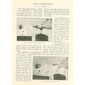  1904 Medicine Fomentation Treatment illustrated 